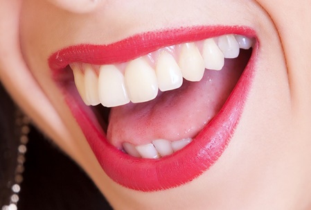 Lachender Mund mit schönen Zähnen